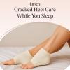 imageKitsch Moisturizing Socks for Cracked Heel Treatment  Reusable Spa Socks for Women ampamp Men with Insulated Gel Lining  Overnight Heel Socks for Dry Cracked Feet Hydrating OpenToe Design  1 PairCream